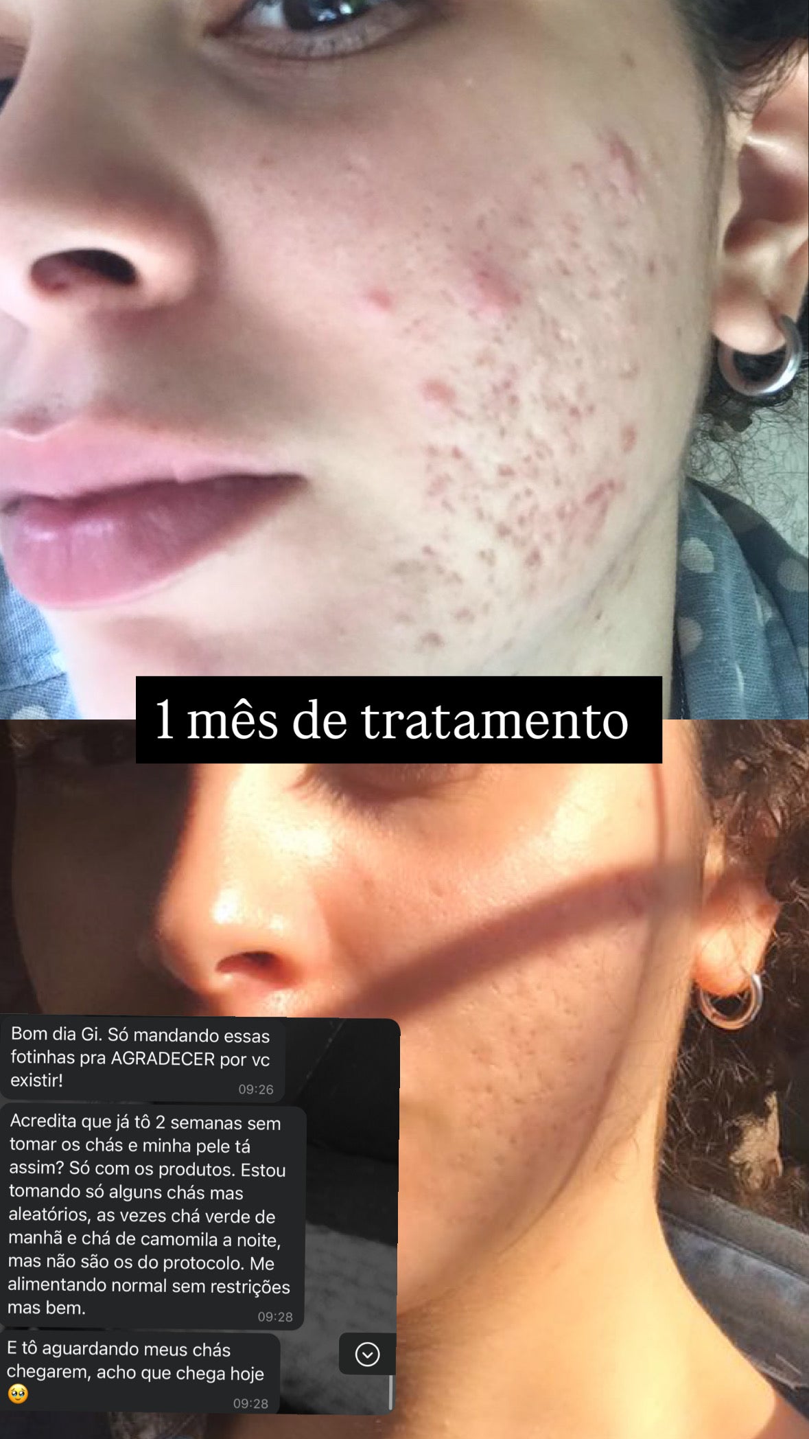 Kit Poderosa
